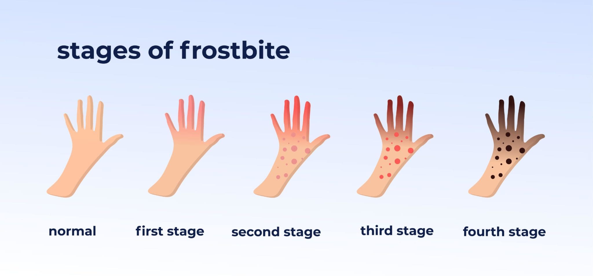 How to Safely Change a Forklift Propane Tank [Stepby Step Guide]